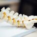 Ilustra huesos de la Columna Vertebral, tema del que habla el Centro de la Columna Vertebral