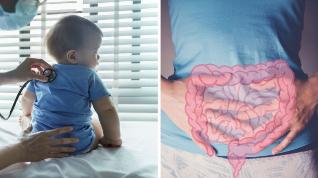 primer-trasplante-intestino-bebe