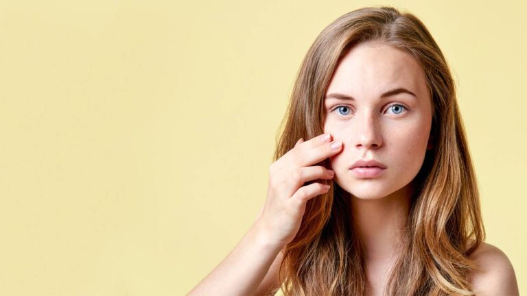 acne-ficha_e85307cb_1280x720