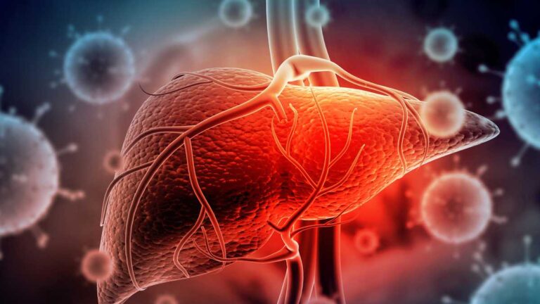 hepatitis a