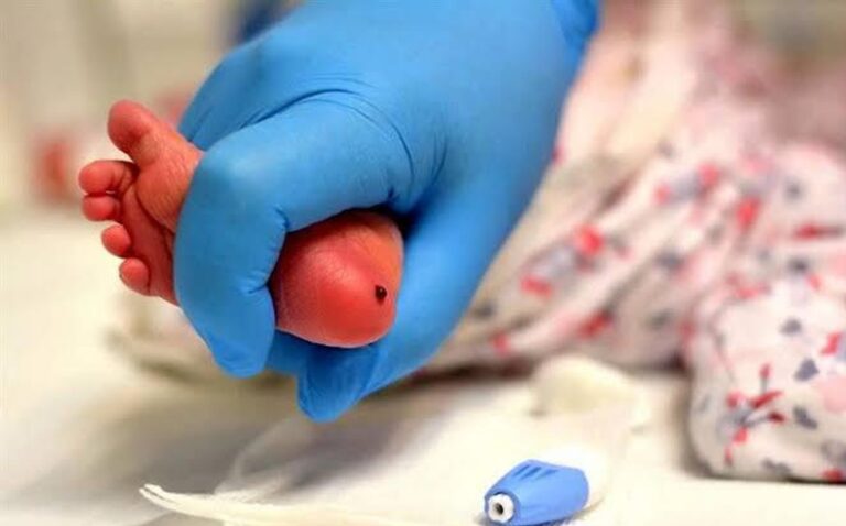 tamiz-neonatal-necesario-bebes-foto