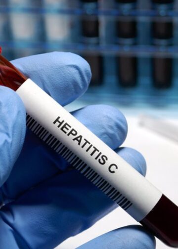 Hepatitis C treatment

Hepatitis C - sexually transmitted disease blood test and treatment
ESPAÑA EUROPA SALUD MADRID
HAILSHADOW
