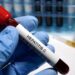 Hepatitis C treatment

Hepatitis C - sexually transmitted disease blood test and treatment
ESPAÑA EUROPA SALUD MADRID
HAILSHADOW