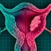 Atienden a 1,700 mujeres con programa Micaela contra cáncer cervicouterino