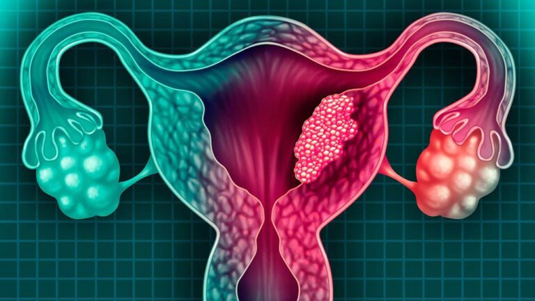 Atienden a 1,700 mujeres con programa Micaela contra cáncer cervicouterino