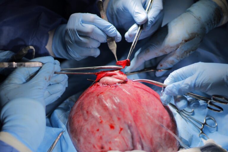 fetal