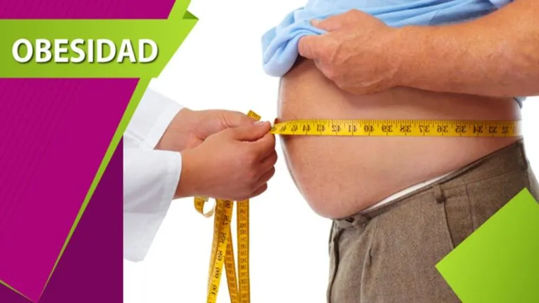 obesidad