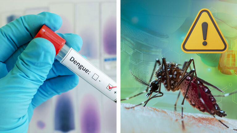 dengue