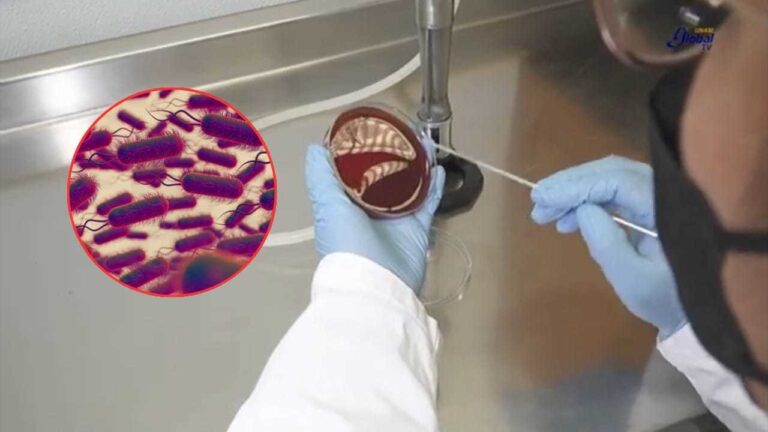 Klebsiella oxytoca