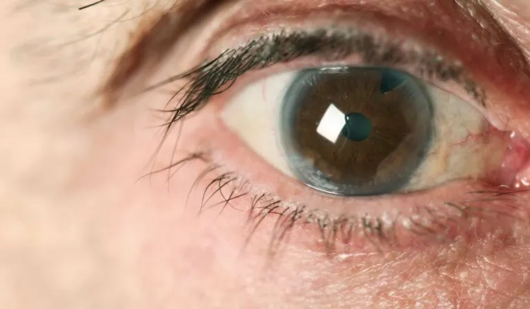 xr:d:DAFnv3KZNvg:5,j:2871440313819007641,t:23070508