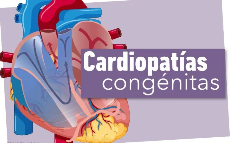 cardiopatías congénitas