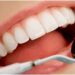 08/02/2018 PIXABAY.

Es muy importante que nos preocupamos por mantener una buena salud bucodental, y para ello existe una serie de recomendaciones las cuales deberemos tener en cuenta para poder conseguirlo y garantizar un control adecuado.

ESPAÑA EUROPA MADRID SOCIEDAD
PIXABAY