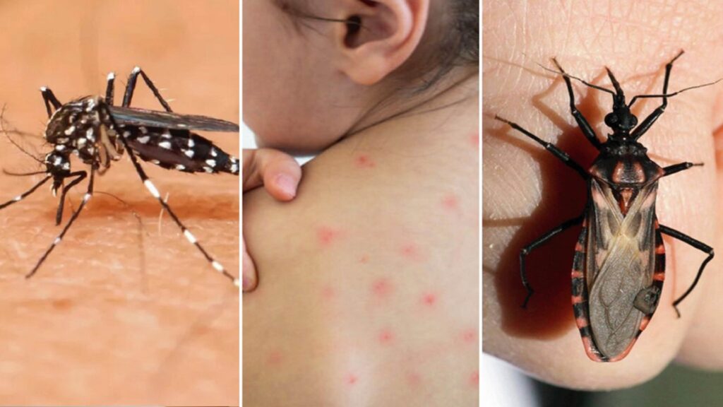 chagas