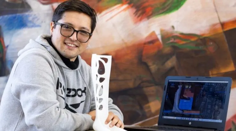 Diseñan prótesis usando la cámara del celular