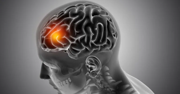 3D male medical figure with front of the brain highlighted
