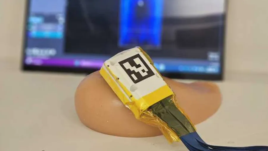 escaner