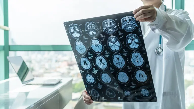 neuroinflamación
